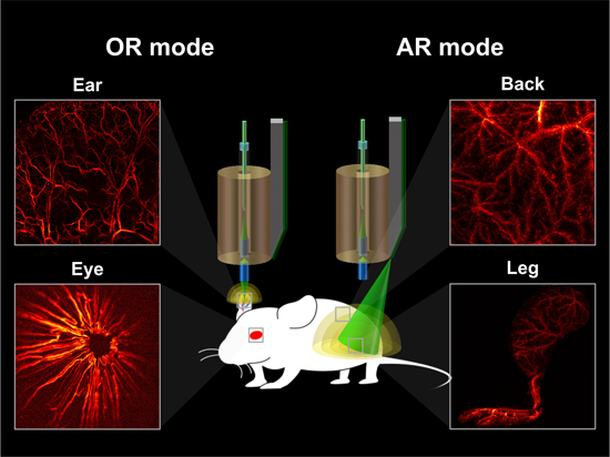 Miniaturization of optical- and acoustic-resolution photoacoustic microscopy scan head for scalable resolution and depth in endoscopy - Advances in Engineering